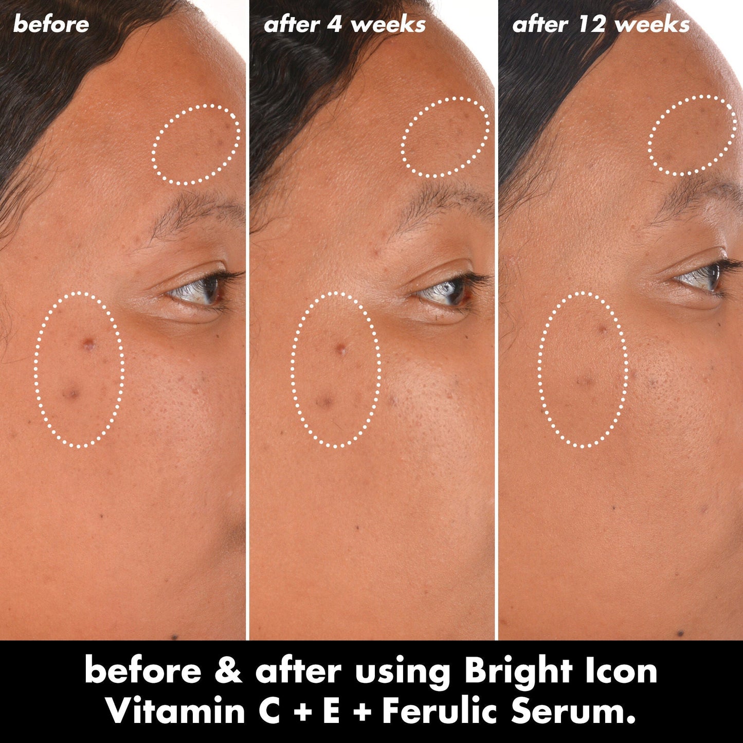bright-icon-vitamin-c-e-ferulic-serum-e8 0226_EDU_BrightIconVitC_BA_Chanel_TRIPTYCH_c58f2fc8-209d-414f-9ba3-666a07a94887.jpg