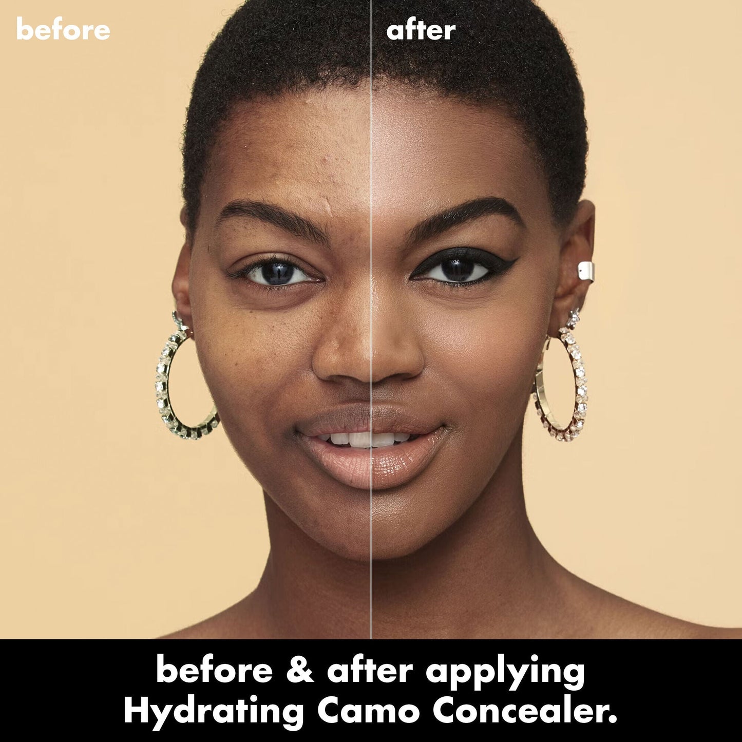 hydrating-camo-concealer-z6 0226_EDU_HydratingCamoConcelaer_BA_AshleyKaresh_20_1_d8499bbf-0e91-4173-b5e2-75127caf83a3.jpg