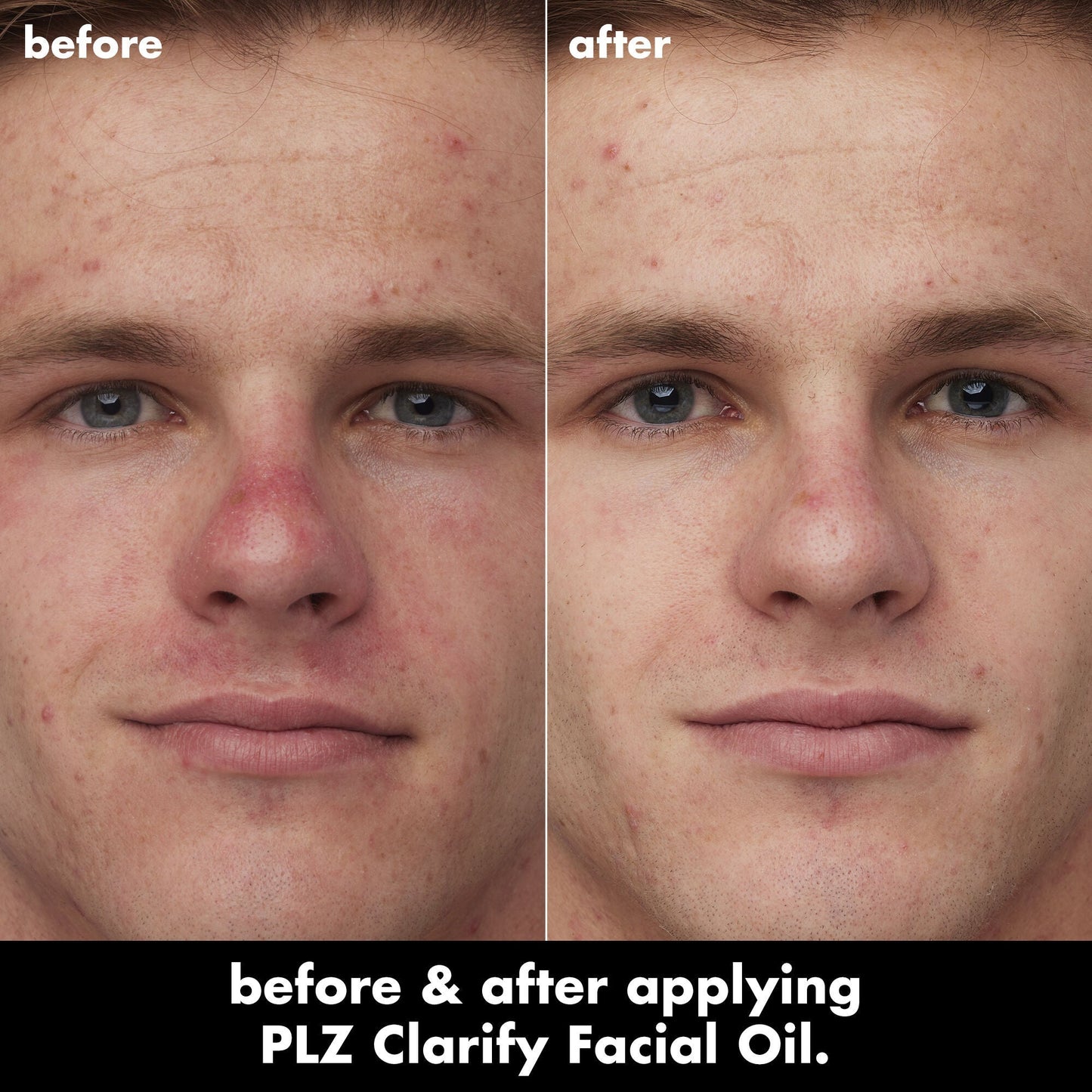 plz-clarify-facial-oil-c3 0326_EDU_PlzClarify_BA_Caleb.jpg