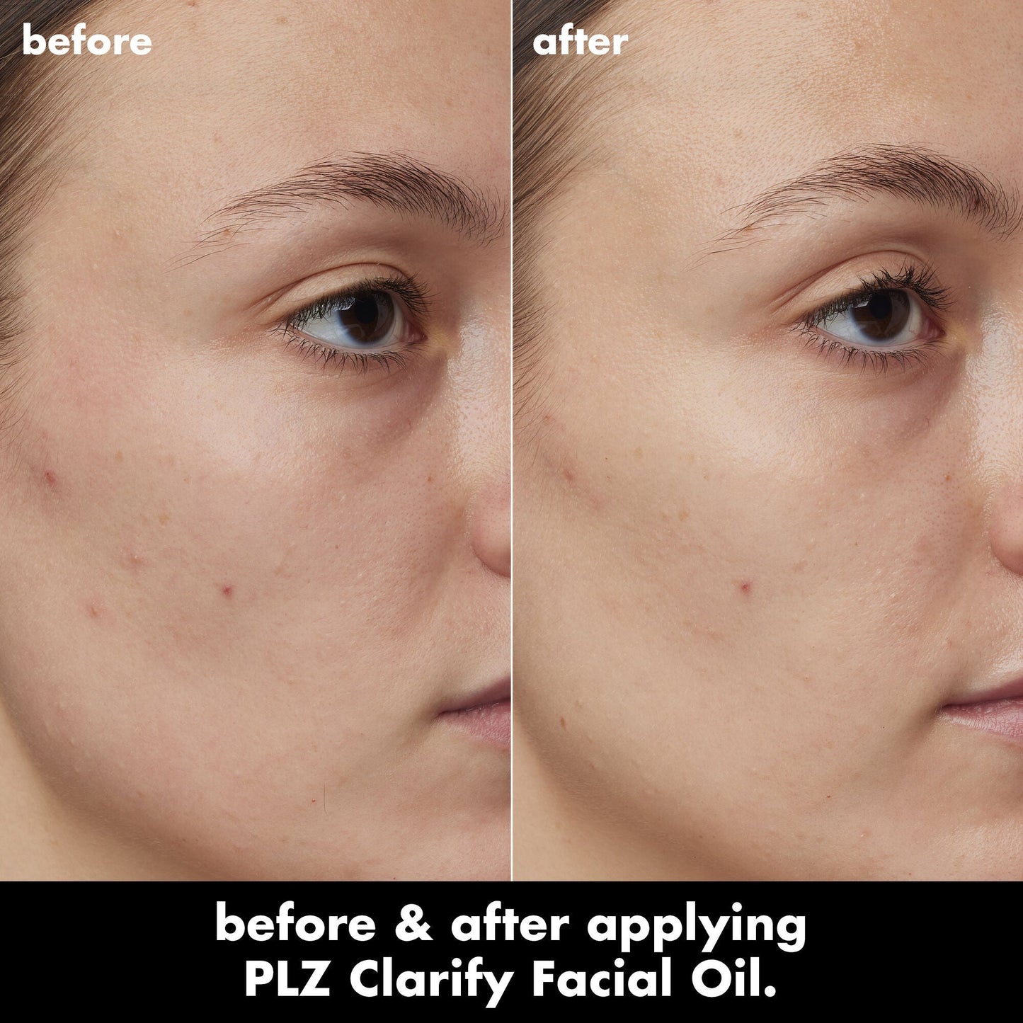 plz-clarify-facial-oil-c3 0326_EDU_PlzClarify_BA_Kelly.jpg