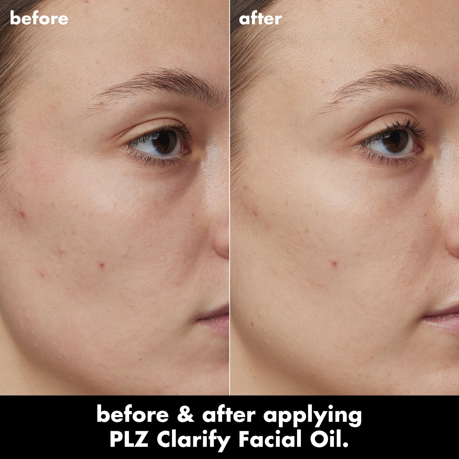 plz-clarify-facial-oil-c3 0326_EDU_PlzClarify_BA_Kelly.jpg