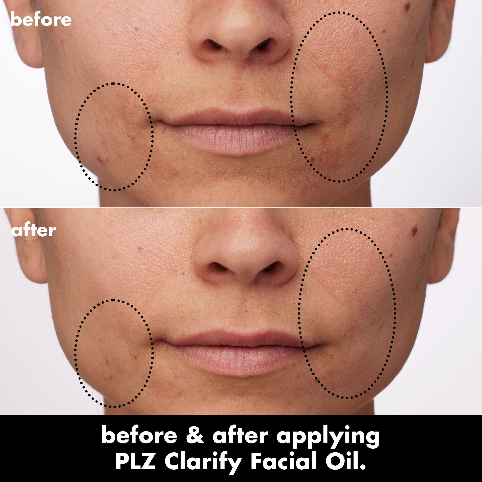 plz-clarify-facial-oil-c3 0326_EDU_PlzClarify_BA_Paula.jpg