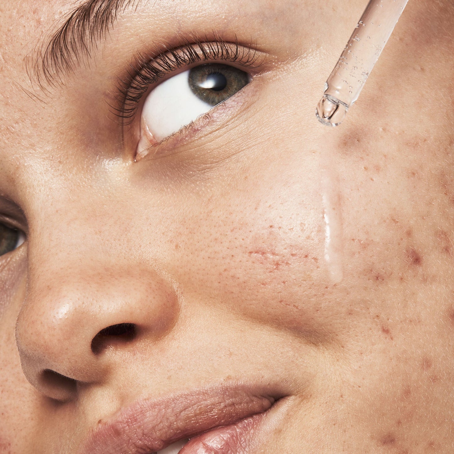 blemish-breakthrough-triple-acid-resurfacing-serum-z1 121321_Marley-Acne-Regimen_0254_FINAL_IGF.jpg