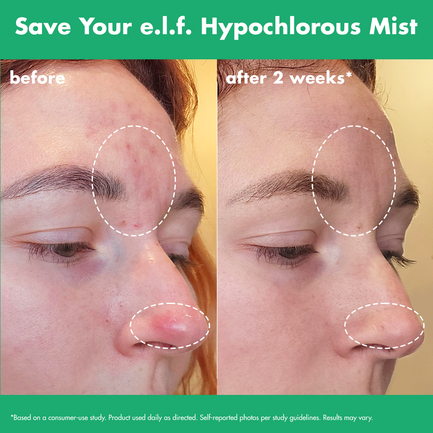 save-your-e-l-f-hypochlorous-mist-o2 FA26_EDUCATION_SAVEYOURELF_USAGE_BA1_WITHOUT_CLAIMS.png