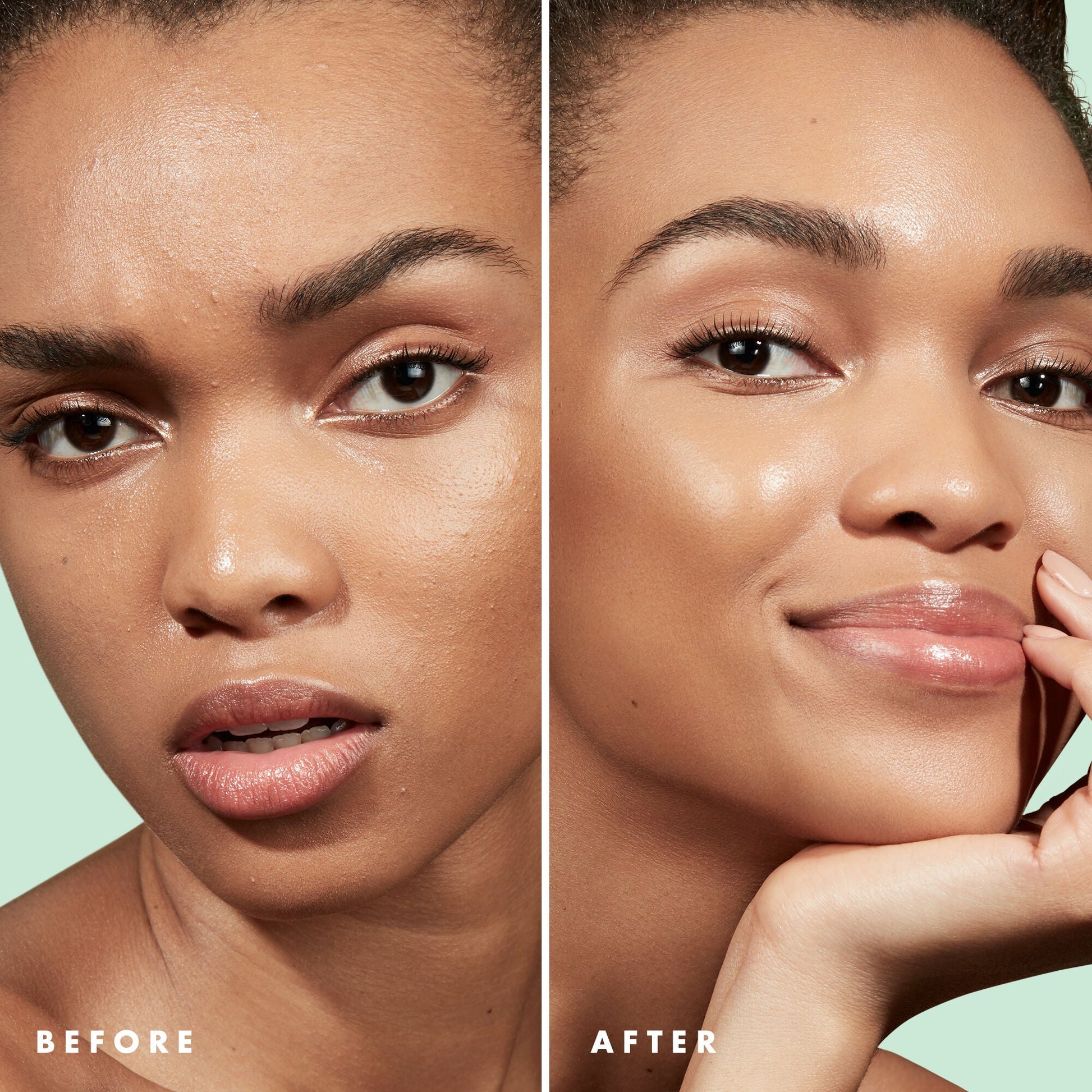 blemish-control-face-primer-large-size-c7 Primer_PP_Before_After_BlemishControl_2000x2000_3774231e-d4e1-49dd-b3d7-a73cbac901fe.jpg